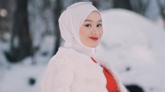 7 Potret Cantik Dinda Hauw yang Jadi Korban Kamera Wartawan