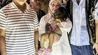 Mengenal Sindrom Manusia Serigala, Penyakit Langka Dialami Bocah di Malaysia