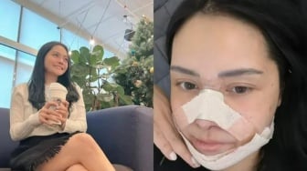 Before-After Wajah Mawar AFI Pasca Oplas, Langsung Pergi ke Korea