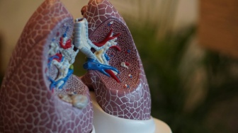 Mudah Diperoleh, Berikut 3 Bahan Alami untuk Menyehatkan Paru-paru