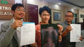 Anak Aspri Hotman Paris jadi Korban Pengeroyokan, Pelaku Ngaku Anak Jenderal