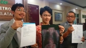 Profil Muhammad Iqbal: Anak Aspri Hotman Paris Dikeroyok Anak Jenderal, Mirip Kasus Mario Dandy?