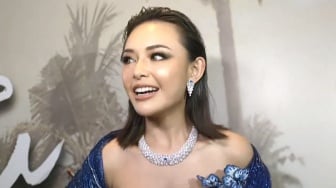 Sering Dikira Veneer, Amanda Manopo Ternyata Memiliki Gigi Putih karena Kebiasaan Ini