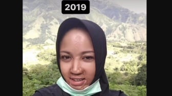 Wajah Cantik Driver Ojek Online di Makassar Rusak Disiram Air Keras