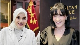 Beda dari Aurel Hermansyah, Muka Asli Kiki Amalia Pasca Lahiran Banjir Pujian