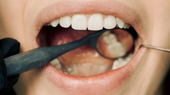 3 Cara Simpel Jaga Kesehatan Mulut dan Gigi Selama Ramadan