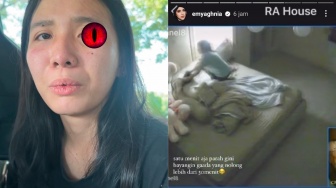 Fakta-Fakta Kasus Penganiayaan Anak Selebgram Emy Aghnia, Pelaku Terancam 5 Tahun Penjara