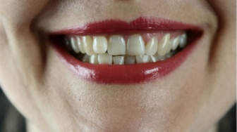 3 Kebiasaan yang Tanpa Disadari Menimbulkan Masalah pada Gigi dan Mulut