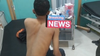 Ngeri, Pelajar Nyambi Ojol di Bantul jadi Korban Klitih, Celurit masih Tertancap di Bahu Kanan