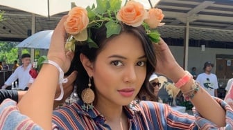 Aurelie Moeremans Bawa Kabar Buruk, Bagian Otaknya Menyusut Imbas Kecelakaan