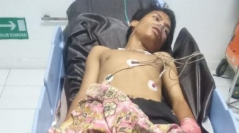 Pelaku Tawuran yang Sebabkan Korban Tangan Putus Ditangkap di Padang