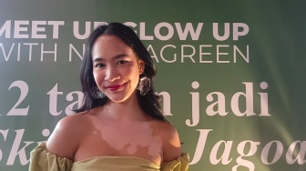 Percaya Diri dengan Vitiligo, Salma Kyana Ungkap Makna Kecantikan