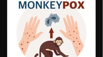 Monkeypox Penyakit Apa? Kenali Ancaman Kesehatan yang Menyerang Kulit!