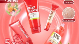 3 Produk Skincare Somethinc Berbahan Succinic Acid, Ampuh Hempaskan Jerawat