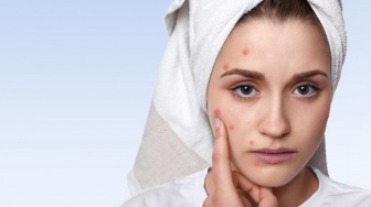 4 Acne Patch Terbaik untuk Angkut Jerawat, Bebas Bekas!