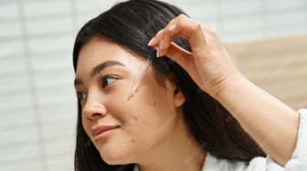 3 Acne Serum Terbaik yang Mengandung Salicylic Acid, Harga Mulai Rp85 Ribu