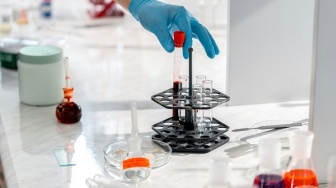 Dosen UGM Tersandung Kasus Stem Cell Ilegal: Praktik Terlarang Terbongkar
