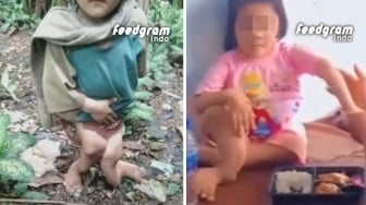 Anak di Nias Dianiaya Tante hingga Kakinya Patah, KPAI: Korban Harus Segera Dapat Perlindungan!