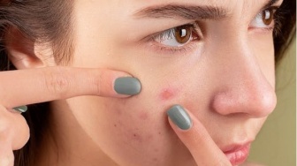 Beda dengan Jerawat Biasa, Kenali Fungal Acne dan Ketahui Penyebabnya