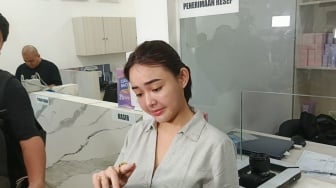 Beda dari yang Lain, Amanda Manopo Pakai Jam Tangan di Jari Telunjuk