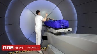 Terobosan Baru Pengobatan Kanker, Benarkah Prosesnya Hanya Kurang dari Satu Detik?