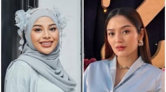 Beda Perubahan Fisik Aurel Hermansyah dan Siti Badriah Saat Hamil, Ada yang Kudisan