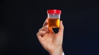 Jangan Anggap Sepele! Inilah 5 Ciri Urine Pertanda Ginjal Anda Terancam