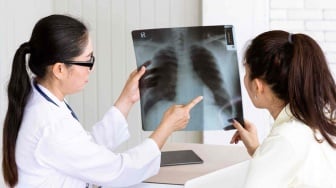 77 Persen Sembuh, Kaltim Masih Kejar Target Nasional TBC RO