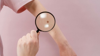 7 Tanda Leukemia yang Muncul di Kulit: Mulai dari Kurap hingga Ruam Aneh