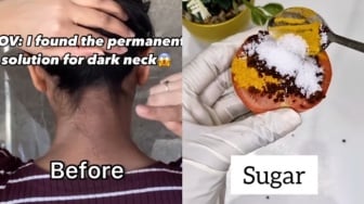 Memutihkan Tengkuk Gelap Ternyata Sangat Mudah, Cuma Gunakan 4 Bahan Dapur Ini