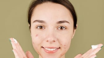 Urutan Basic Skincare Viva Pagi Hari, Ampuh untuk Kulit Berjerawat
