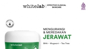 5 Rangkaian Skincare Harian untuk Kulit Berjerawat Rekomendasi Dokter Estetika