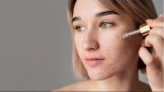 4 Brightening Serum yang Viral di TikTok Efektif Pudarkan Bekas Jerawat