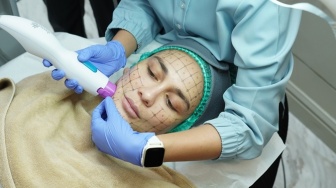 Intip Treatment Luna Maya Sebelum Pernikahan, Kulit Jadi Terlihat Lebih Awet Muda