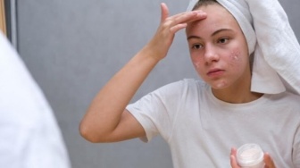 4 Rekomendasi Moisturizer Terbukti Ampuh Mempercepat Penyembuhan Jerawat