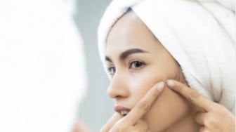 Jerawatan Gak Bikin Galau! Ini Rekomendasi 5 Produk Wardah Biar Wajah Tetap Fresh