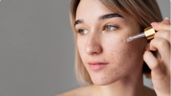 5 Rekomendasi Serum Tranexamic Acid Terbaik: Mulai Rp30 Ribuan, Ampuh Atasi Jerawat PIE dan PIH