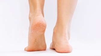 10 Rekomendasi Krim Kaki Terbaik (Foot Cream) untuk Kulit Kering dan Kapalan