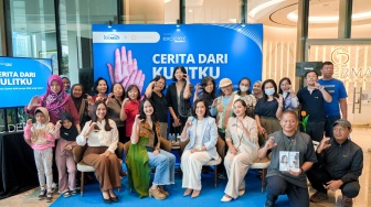 Kenali Vitiligo di World Vitiligo Day 2025, C Derma Ajak Penyintas Lebih Percaya Diri