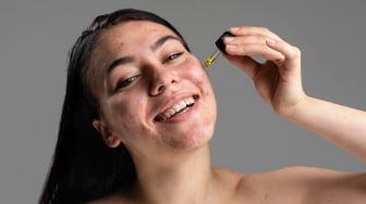 7 Rekomendasi Serum untuk Menghilangkan Bekas Jerawat dan Bruntusan, Mulai Rp80 Ribuan