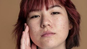 6 Skincare untuk Menghilangkan Bopeng Bekas Jerawat: Perbaiki Skin Barrier, Mulai Rp60 Ribuan