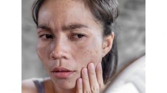 5 Serum Viva untuk Flek Hitam Usia 40 Tahun Keatas, Hempaskan Penuaan Dini