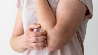 6 Rekomendasi Bedak Gatal Mengandung Salicylic Acid, Ampuh Lawan Biang Keringat dan Bau Badan