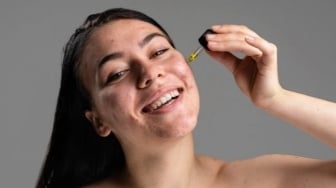 4 Serum Hilangkan Bekas Jerawat, Harga Terjangkau di Bawah Rp50 Ribuan!