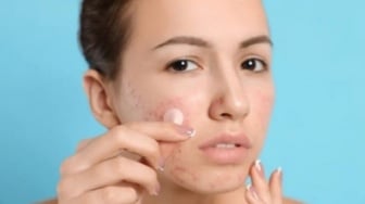 4 Acne Patch Atasi Jerawat Bernanah, Harga Terjangkau di Bawah Rp30 Ribuan!