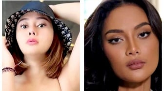 Sama-sama Hamil di Luar Nikah, Denise Chariesta dan Erika Carlina Alami Nasib Berbeda