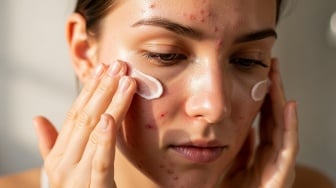 7 Moistuzier untuk Kulit Berminyak Non-Comedogenic: Welcome Kulit Sehat, Bye-bye Jerawat!