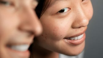 Cara agar Flek Hitam di Wajah Cepat Mengelupas, Ini 4 Rekomendasi Produk Retinol yang Bisa Membantu