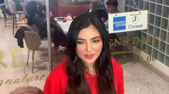 Wajah Bengkak Diledek Mirip Habis Oplas, Ashanty: Ini karena Obat Steroid