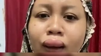 4 Fakta Viral Bibir Bengkak 3 Jam Sebelum Akad Nikah, Pengantin Wanita Asal Bekasi Kaget!